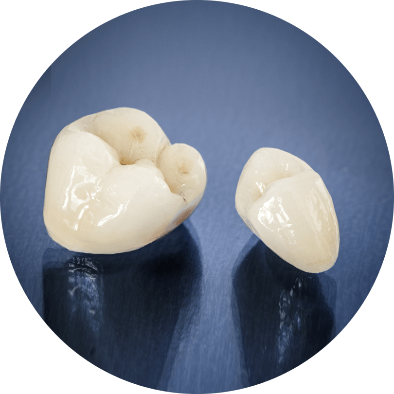dental crowns model