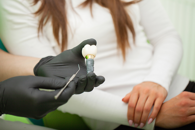 doctor with model of implant