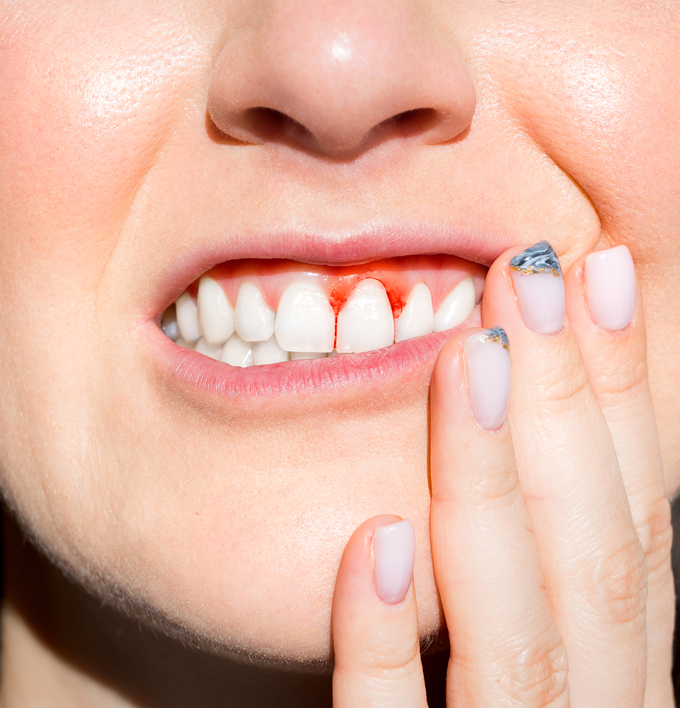 Person experiencing signs of gum disease