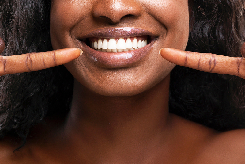 woman showing off her new veneers