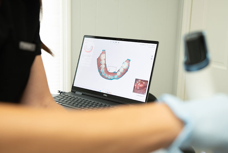3d scan on screen