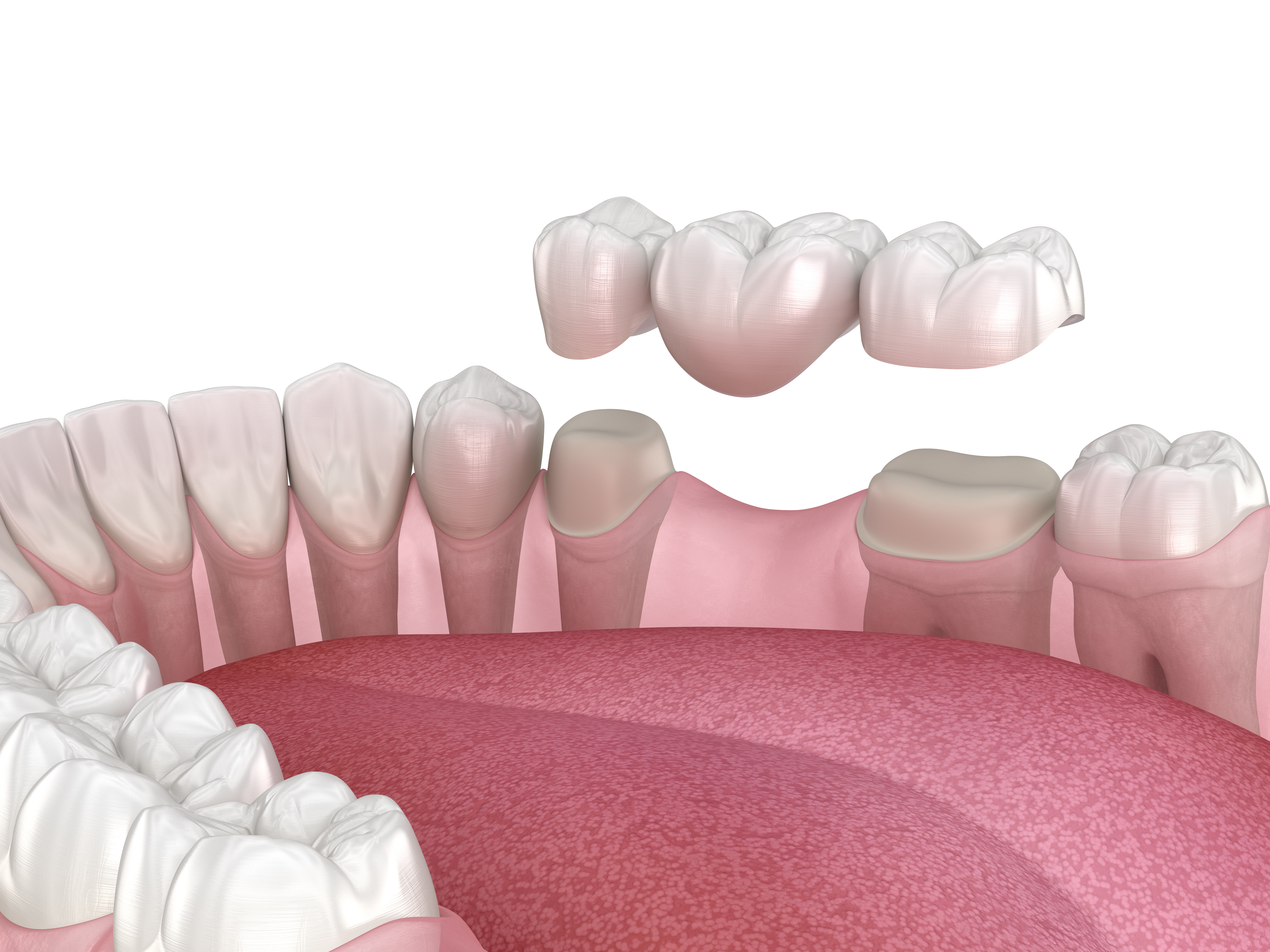 Patient smiling after restorative dental treatment