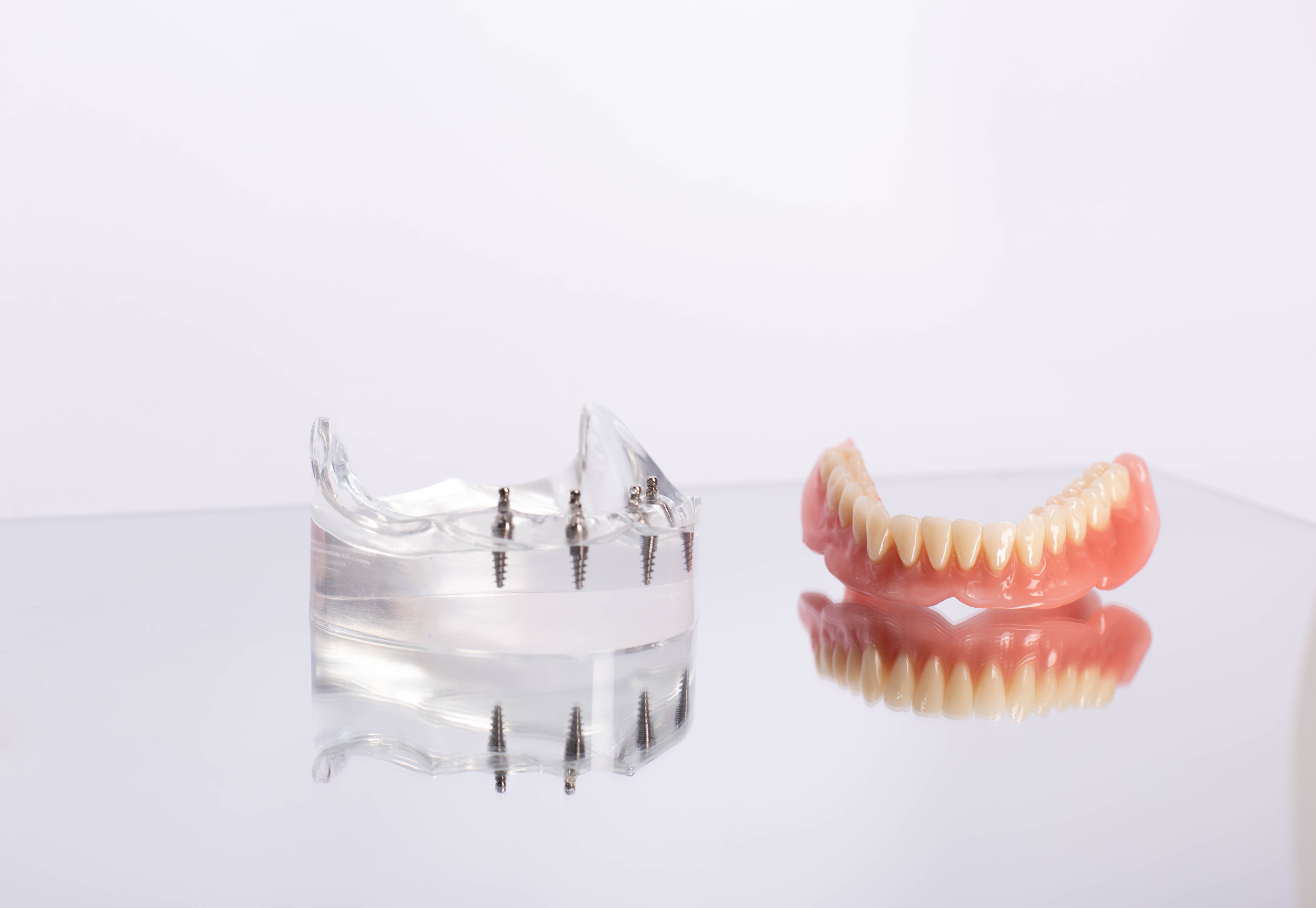 Implant-supported dentures
